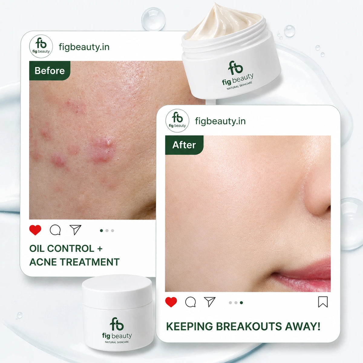 Best whitening cream, face whitening cream, whitening cream